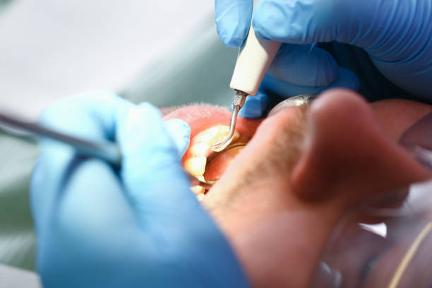 Best Mobile Emergency Dentist in Lewisville, TX