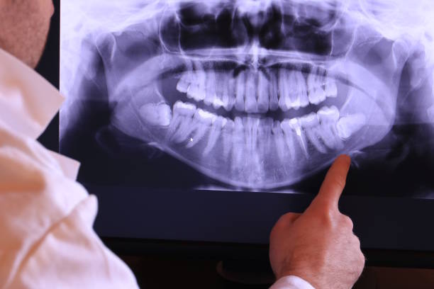 Best Weekend Emergency Dentist in Lewisville, TX
