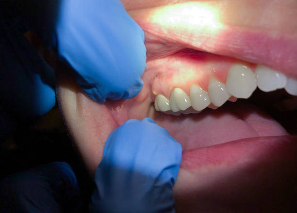 Best Orthodontic Emergency Dentist in Lewisville, TX