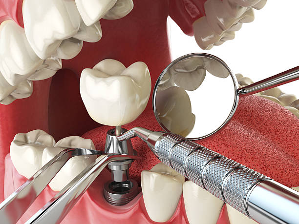 Best Holiday Emergency Dentist in Lewisville, TX